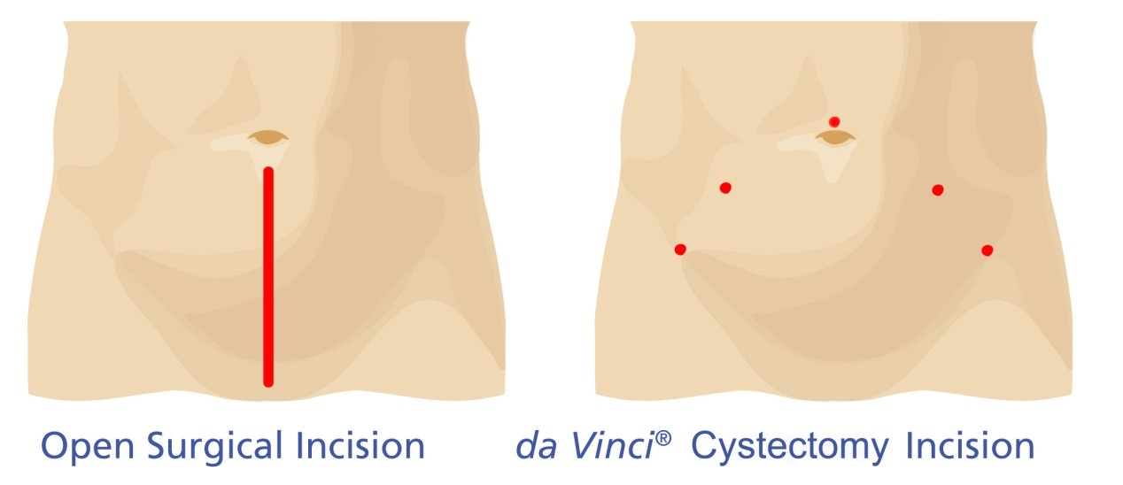 &Rho;&omicron;&mu;&pi;&omicron;&tau;&iota;&kappa;ή &Kappa;&upsilon;&sigma;&tau;&epsilon;&kappa;&tau;&omicron;&mu;ή
