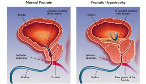 &Kappa;&alpha;&lambda;&omicron;ή&theta;&eta;&sigmaf; &Upsilon;&pi;&epsilon;&rho;&pi;&lambda;&alpha;&sigma;ί&alpha; &Pi;&rho;&omicron;&sigma;&tau;ά&tau;&eta;