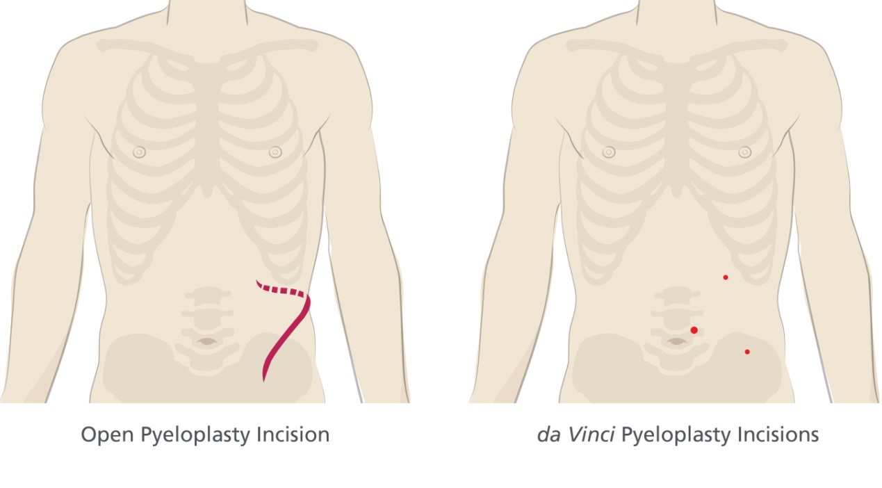 &Rho;&omicron;&mu;&pi;&omicron;&tau;&iota;&kappa;ή &Pi;&upsilon;&epsilon;&lambda;&omicron;&pi;&lambda;&alpha;&sigma;&tau;&iota;&kappa;ή