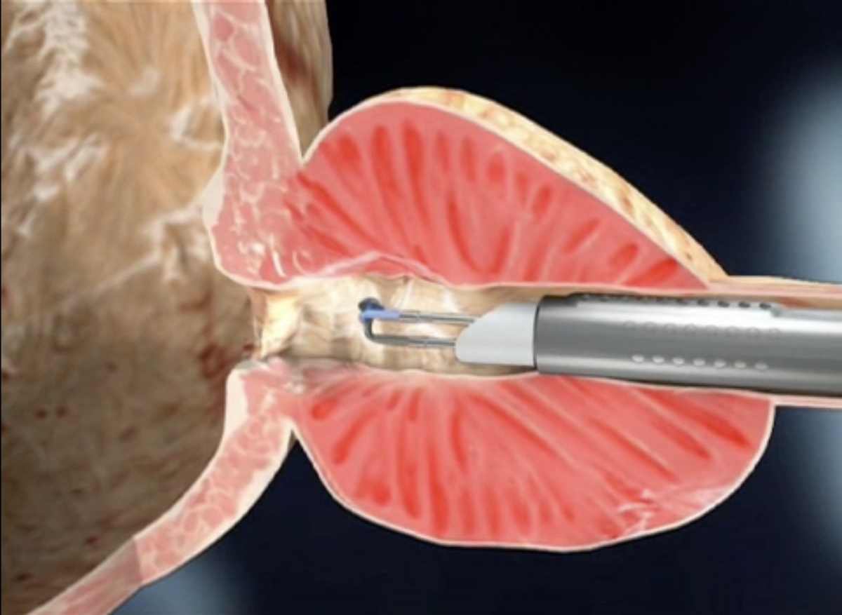 turis &pi;&rho;&omicron;&sigma;&tau;&alpha;&tau;&epsilon;&kappa;&tau;&omicron;&mu;ή