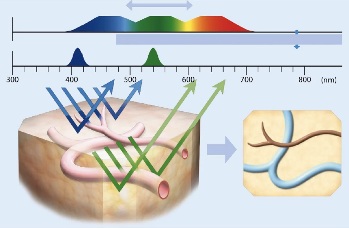 &Kappa;&upsilon;&sigma;&tau;&epsilon;&omicron;&sigma;&kappa;ό&pi;&eta;&sigma;&eta; &mu;&epsilon; &tau;&epsilon;&chi;&nu;&omicron;&lambda;&omicron;&gamma;ί&alpha; &laquo;&Alpha;&pi;&epsilon;&iota;&kappa;ό&nu;&iota;&sigma;&eta;&sigmaf; &Sigma;&tau;&epsilon;&nu;&omicron;ύ &Phi;ά&sigma;&mu;&alpha;&tau;&omicron;&sigmaf;&raquo; 
