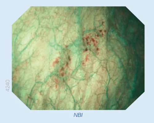 &Kappa;&upsilon;&sigma;&tau;&epsilon;&omicron;&sigma;&kappa;ό&pi;&eta;&sigma;&eta; &mu;&epsilon; NBI